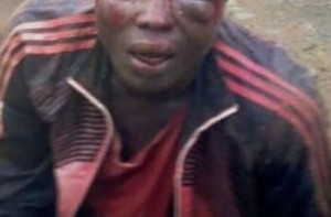 Côte d'Ivoire: Un microbe brûlé vif à  Cocody