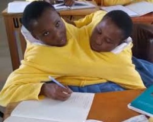 Tanzanie:  Abandonnées  par leur mère, des jumelles siamoises  admises à  l'université