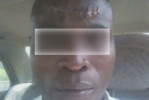 Côte d'Ivoire: Le professeur tabassé par les gendarmes à  San Pédro libéré, il décide de porter plainte