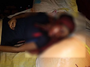 Cameroun: Une jeune dame sauvagement égorgée, son partenaire soupçonné