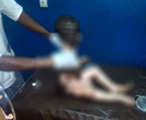 Côte d'Ivoire: Abengourou, une bouteille de gaz explose dans un domicile, des blessés par brûlure enregistrés