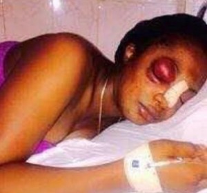 RDC: Une jeune femme meurt après avoir été tabassée par son mari à  Kinshasa