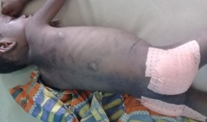 Côte d'ivoire: SOS pour un garçonnet victime de sévices corporels de la part de son oncle pour avoir mangé la tête de cabri