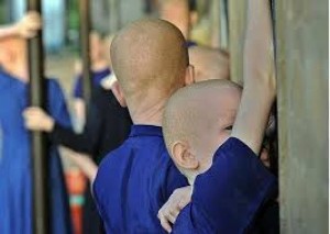 Malawi:  Une  mère  inculpée pour l'enlèvement de son fils albinos