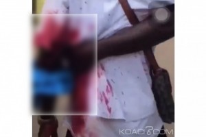 Côte d'Ivoire: Un quartier de Yopougon assailli par les microbes, des blessés à  l'arme blanche