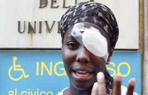 Nigeria-Italie: Agression raciste, une athlète  blessée à  l'oeil après des jets d'œufs