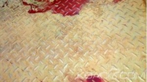 Burkina Faso: Une passagère d'un tricycle blessé par balle après un refus d'obtempérer du conducteur